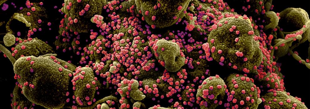 coronavirus e malati di diabete